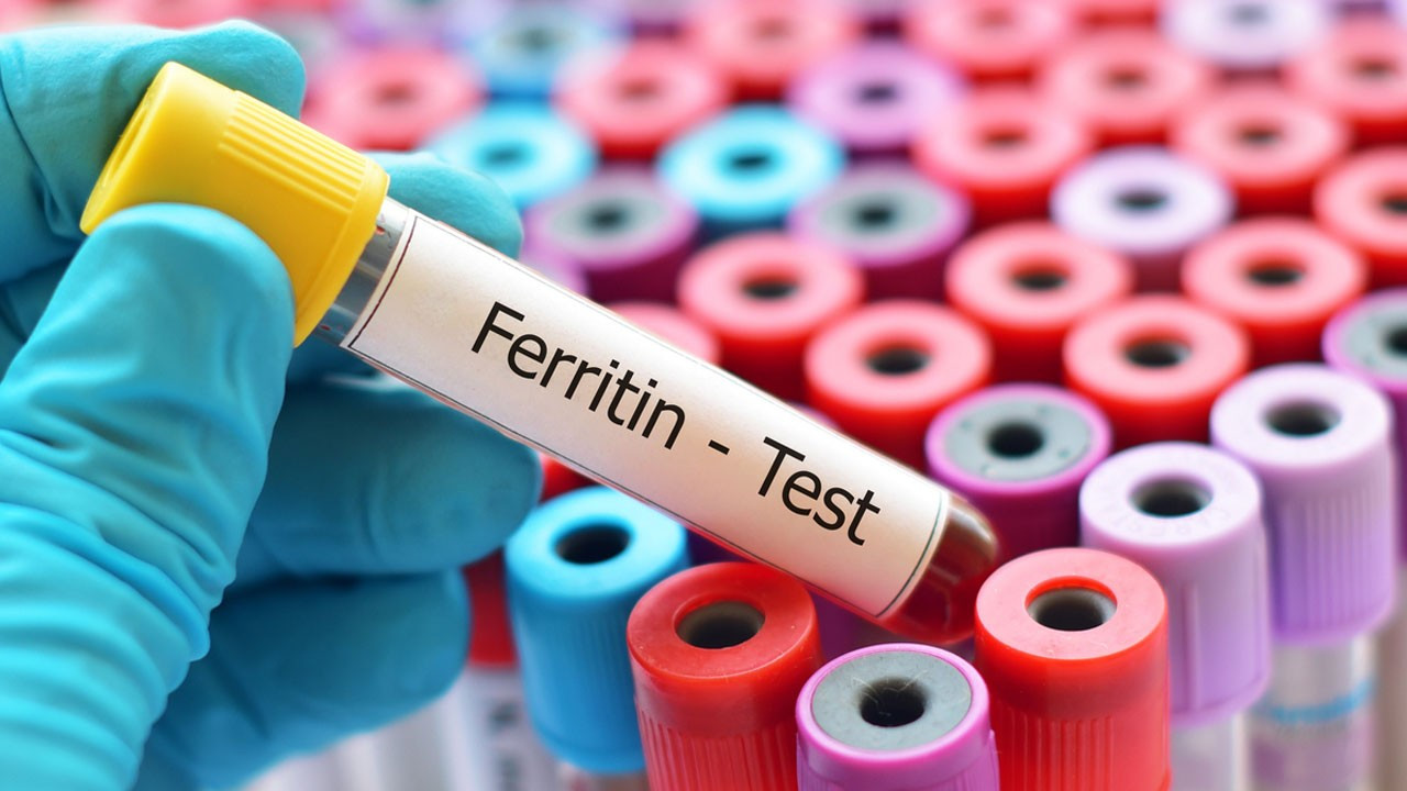 Ferritin nedir? Ferritin düşüklüğü ve yüksekliği ne anlama gelir? 12 soruda ferritin hakkında merak edilenler