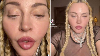 Madonna'nın TikTok videosu gündem oldu: Madonna'nın yüzüne ne oldu?