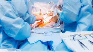 Laparoskopi nedir, neden yapılır? Laparoskopi sonrası iyileşme süresi nasıl olur? 9 soruda laparoskopi