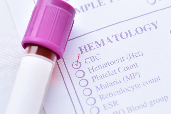 Hemogram (tam kan sayımı) nedir, kaç olmalı? Hemogram düşüklüğü ve yüksekliği neden olur? 23 soruda Hemogram - Resim : 4