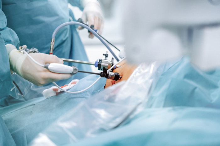 Laparoskopi nedir, neden yapılır? Laparoskopi sonrası iyileşme süresi nasıl olur? 9 soruda laparoskopi - Resim : 3