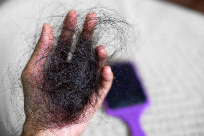 Doğum sonrası saç dökülmesi neden olur, ne zaman geçer? Doğum sonrası saç dökülmesi için tavsiyeler - Resim : 2