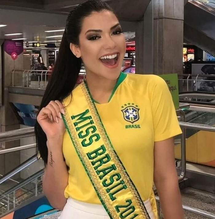 Brezilya tescilli güzeli Gleycy Correia bademcik ameliyatı sonrası hayatını kaybetti - Resim : 1