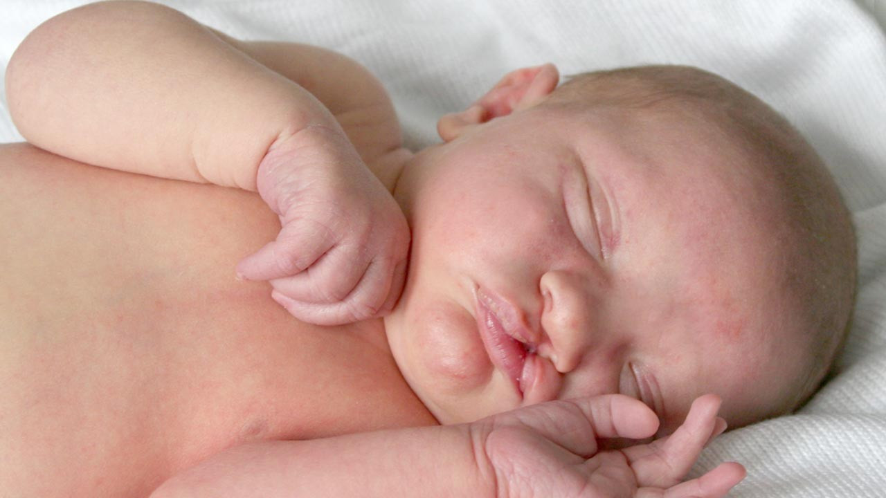 Bebeklerde yarık dudak, yarık damak neden olur?