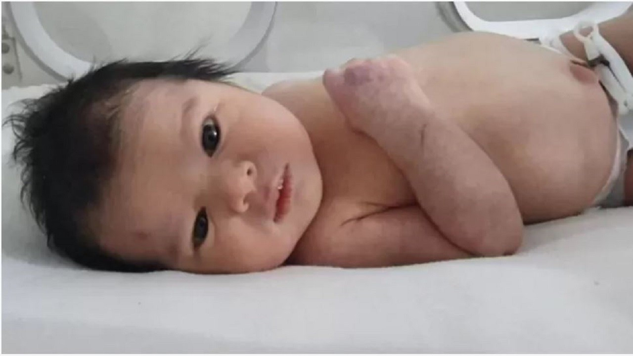 Depremde doğan mucize bebek: Aya