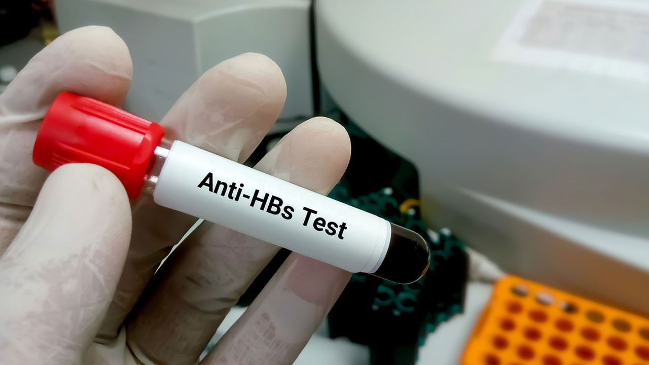 Anti HBs nedir? Anti HBs pozitif ne demek? 10 soruda Anti HBs