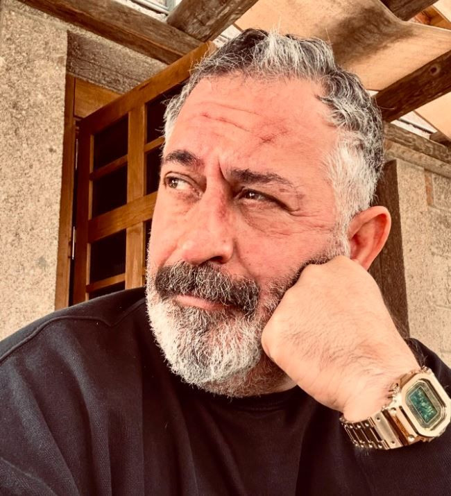 Cem Yılmaz: Sağ gözüm yüzde 50 görmüyor artık