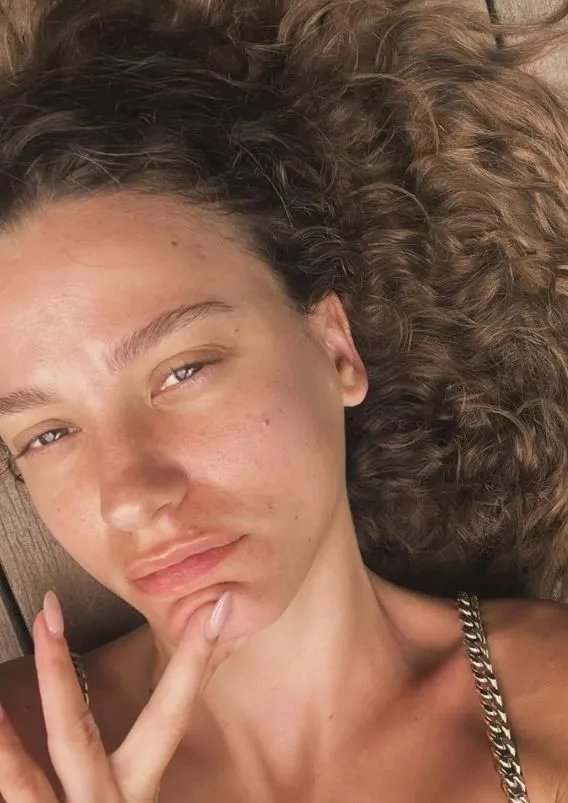 İzel'in son hali şaşırttı! Serenay Sarıkaya'ya benzetildi