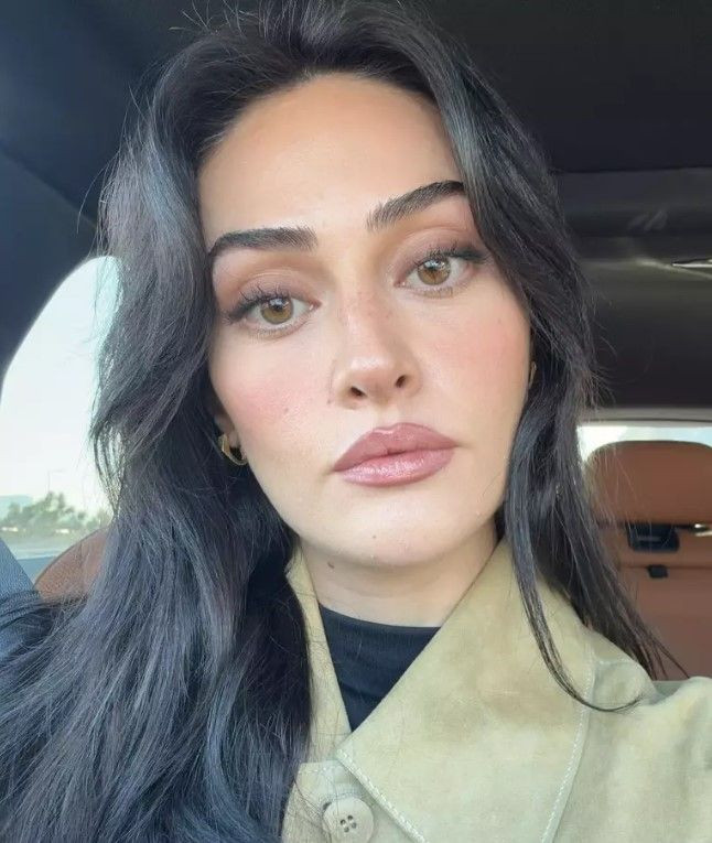 Esra Bilgiç'in son pozuna ünlü isim kayıtsız kalamadı: Göz değil nakış mübarek...