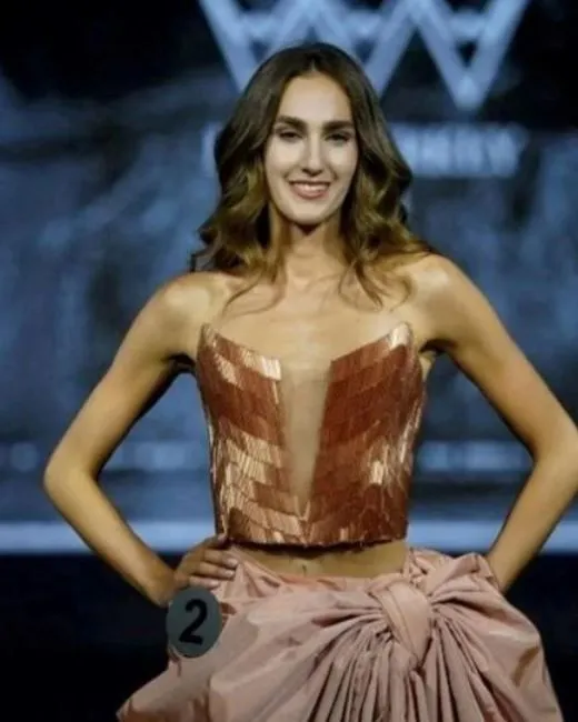 Miss Turkey 2024 birincisi İdil Bilgen yeni fotoğrafını paylaştı! Son haline yorum yağdı