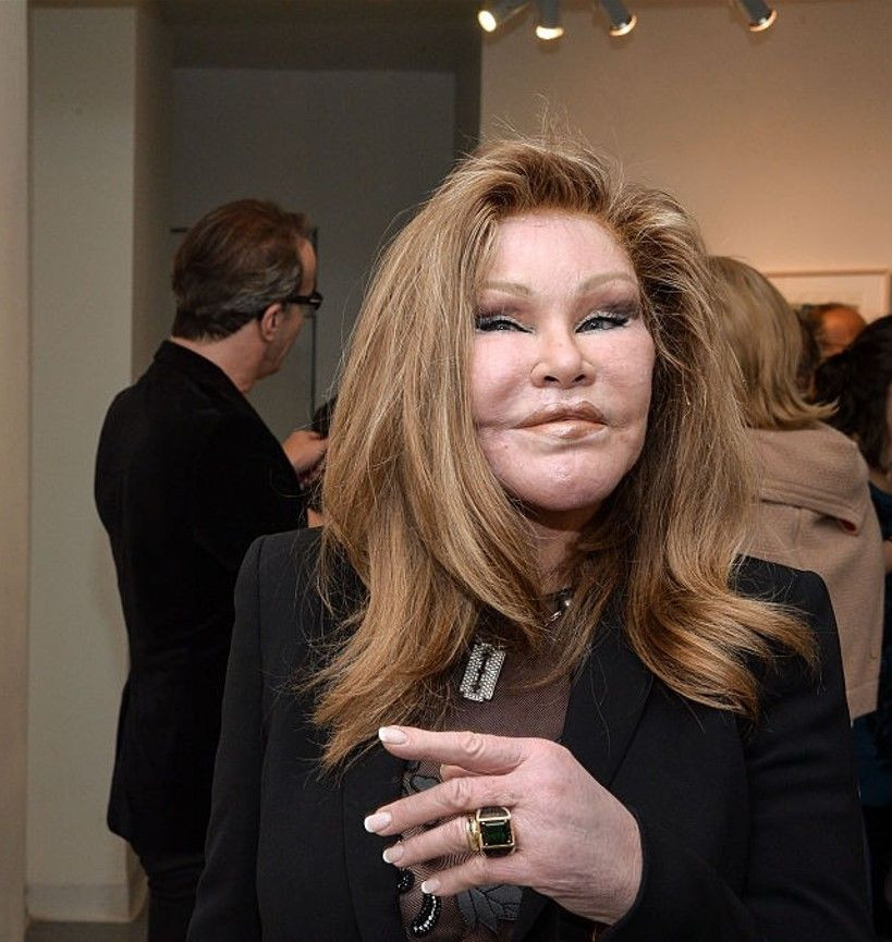 "Kedi Kadın" Jocelyn Wildenstein hayatını kaybetti