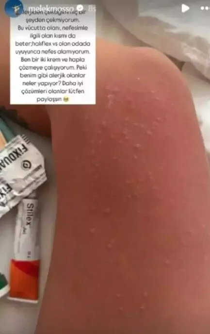 Melek Mosso Bali'de hastanelik oldu! Bali Belly hastalığına yakalandı