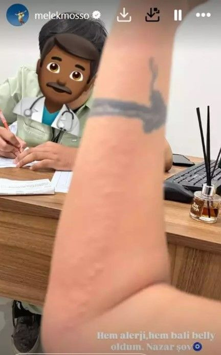 Melek Mosso Bali'de hastanelik oldu! Bali Belly hastalığına yakalandı