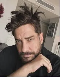 Saç protezini çıkaran Enis Arıkan'a Cengiz İmren benzetmesi!