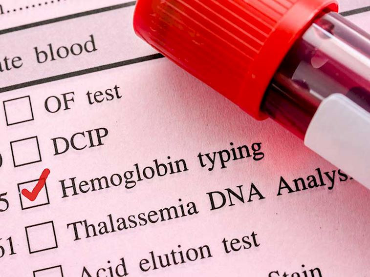HGB nedir? Hemoglobin kan tahlili neden yapılır?