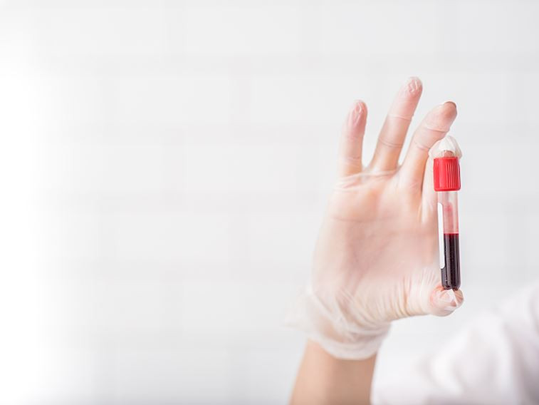 Kan uyuşmazlığı nedir? Hayatımızı nasıl etkiler?